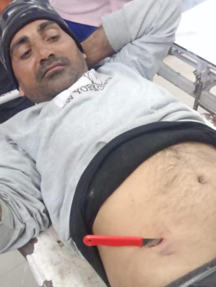 युवक के पेट में फंसा चाकू, अस्पताल पहुंचा तो डॉक्टर भी रह गए हैरान, मेडिकल कॉलेज किया रेफर